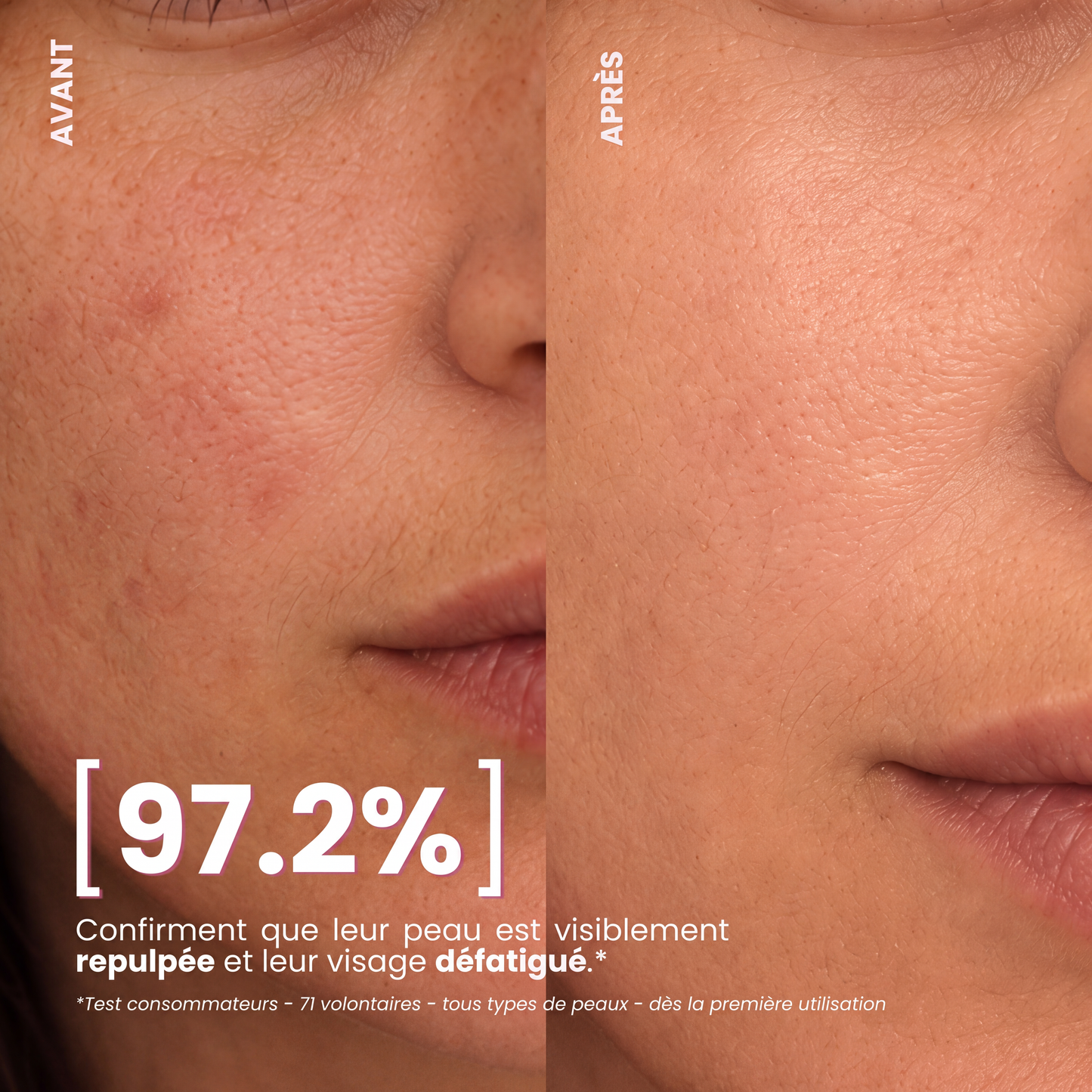 NOVA SKIN® Masque 4H au Collagène